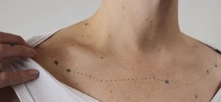 Este posibil de a face un tatuaj pe consiliere de specialitate la fața locului birthmark