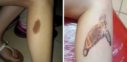 Este posibil de a face un tatuaj pe consiliere de specialitate la fața locului birthmark