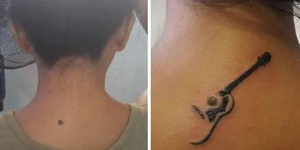 Este posibil de a face un tatuaj pe consiliere de specialitate la fața locului birthmark