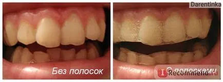 Fogfehérítés fogorvosi csík 360 buyincoins szakmai fogfehérítő szalagok fog