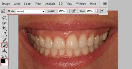 Избелване на зъби в Photoshop - ретуширане на снимки