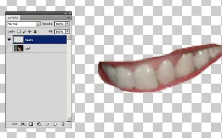 Избелване на зъби Photoshop