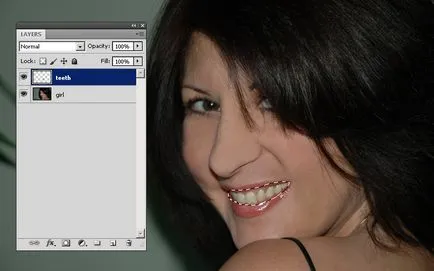 Избелване на зъби Photoshop