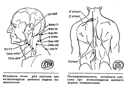 Osteocondrozei tratamentului coloanei vertebrale cervicale de atac folk