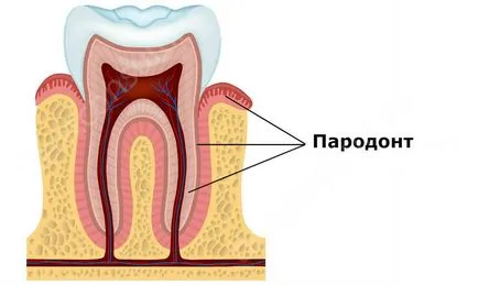 A periodontitis tünetei és paradentózisnál fotó