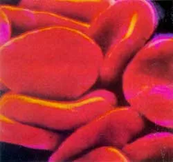 transfuzie de sânge împotriva, pentru sau o alternativă la știință și viață