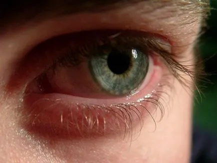 De ce ochii roșii, și cum de a elimina disconfortul