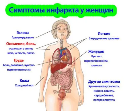 Храна след сърдечен удар при жените (диета)