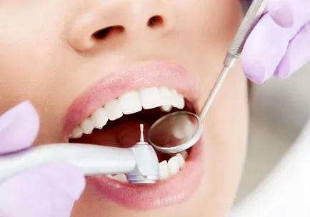 De ce există cariilor dentare și cum să-l trateze
