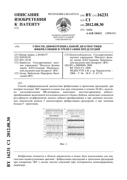 Превенция на инсулт при жените - Лечение на сърдечна