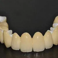 протези разходи с разпрашаване стоматология