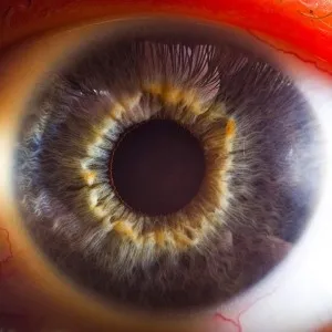 Tapetoretinalnoy abiotrophy retina, szemünk