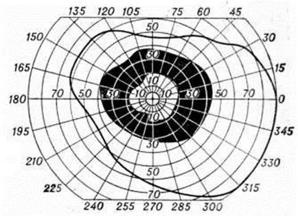 distrofie tapetoretinalnoy