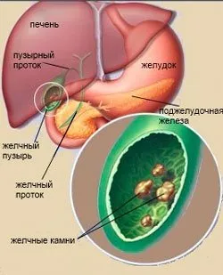 Билки за черен дроб, лечение, пречистване, чай рецепти - живота ми