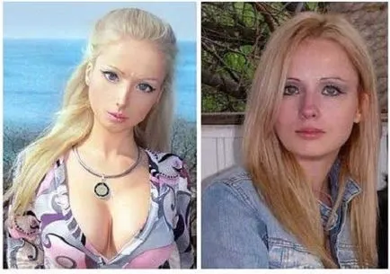 Valeria Lukyanova előtti és utáni képek műanyag