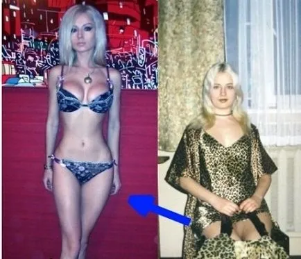 Valeria Lukyanova előtti és utáni képek műanyag