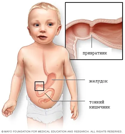 Almaecet és seprűvénák