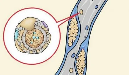 5 acasă căi de atac, care ajuta la vitiligo