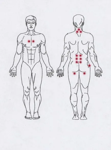 Bioptron utasítás pont kezelés