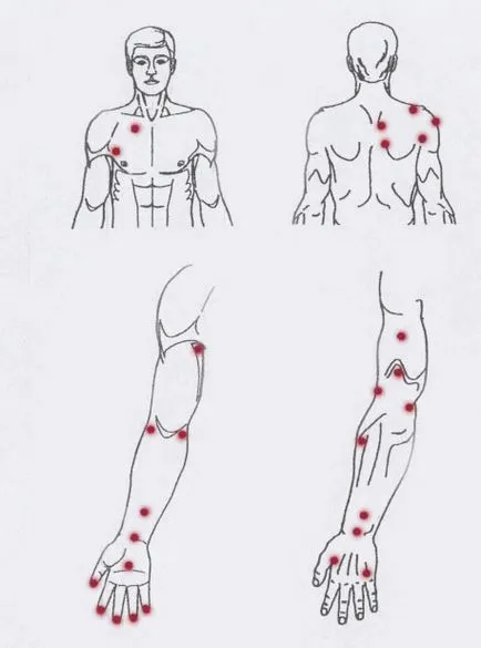 Bioptron utasítás pont kezelés