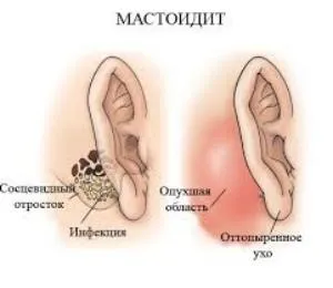 симптоми на човека болестни ухо и лечение