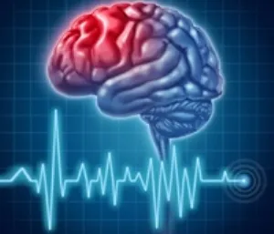 Accident vascular cerebral homeopatie - tratamentul inimii