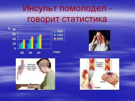 Simptome accident vascular cerebral si diagnostic