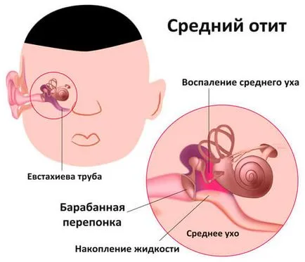 Вдишването ринит при деца, както и за лечение на кашлица