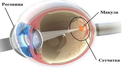 A retina elvékonyodása okait és kezelését szem