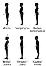 Йога в hyperlordosis лумбален Минск йога клуб йога 108