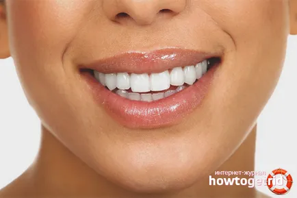 Hogyan javíts görbe fogak tippek