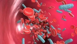 Sepsis - cauze, simptome si remedii populare tratamentul sepsisului