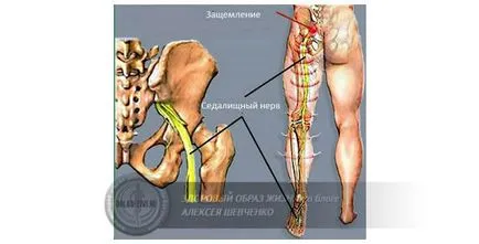 osteocondrozei cervicale și viziune există o legătură între ele