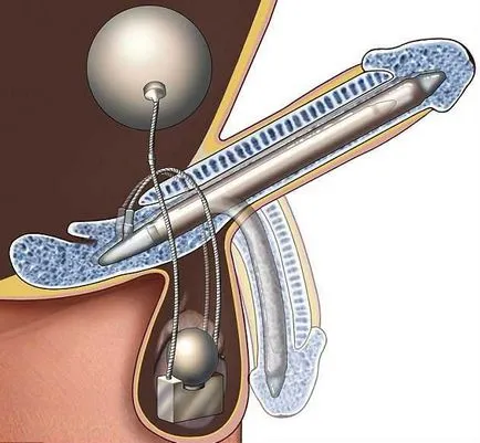 Cum de a crește metode naturale de sex masculin potenta, medicamente, exercitii fizice - portalul urologic