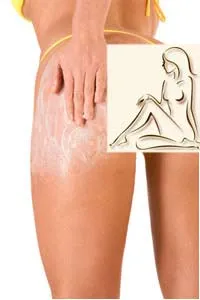 Как да се подобри състоянието на кожата в областта на бедрото и задните части