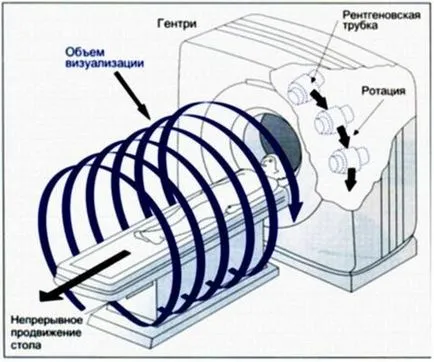 Как да изберем MRI на машината и CT (-магнитен резонанс и компютърна томография)