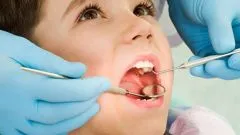 Hogyan védi a fogakat a fogszuvasodás - hogyan védi a fogakat a fogszuvasodás - Egészség és Orvostudomány - mindkettő