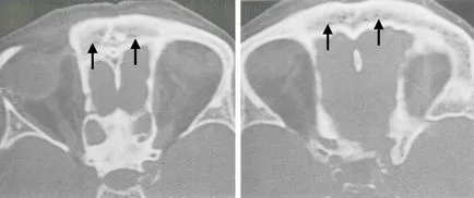 Computerizată anatomie tomografică a organelor ORL, pagina 6