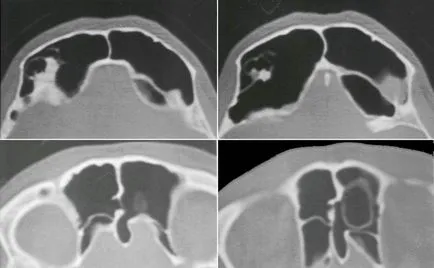 Computerizată anatomie tomografică a organelor ORL, pagina 6