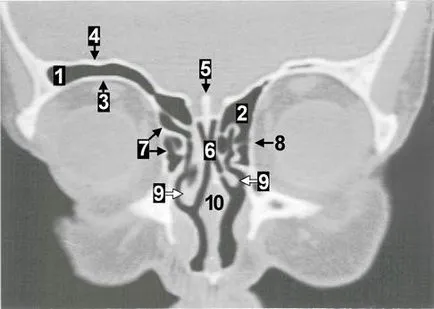 Computerizată anatomie tomografică a organelor ORL, pagina 6