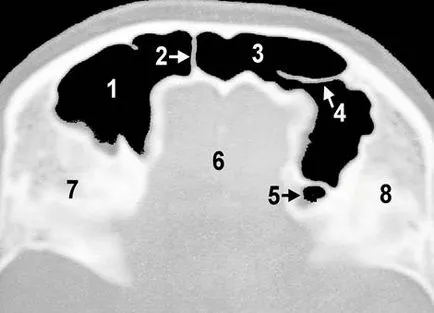 Computerizată anatomie tomografică a organelor ORL, pagina 6