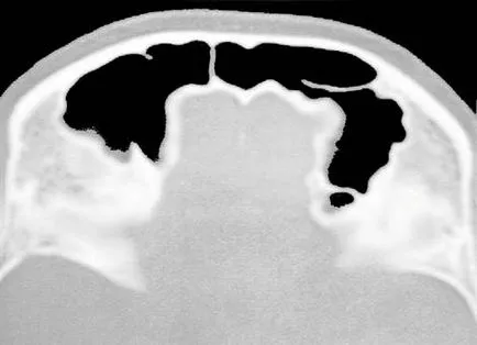 Computerizată anatomie tomografică a organelor ORL, pagina 6