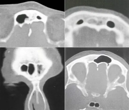 Computerizată anatomie tomografică a organelor ORL, pagina 6