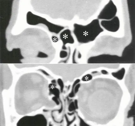 Computerizată anatomie tomografică a organelor ORL, pagina 6