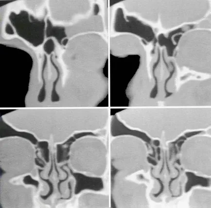 Computerizată anatomie tomografică a organelor ORL, pagina 6