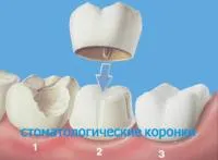 Стоматологично лечение за деца, детска стоматология в Москва