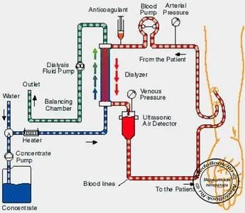 Tratamentul insuficienței renale cronice, tratamentul insuficienței renale cronice, carti medicale, carti