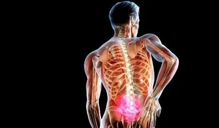 Tratamentul de medicamente hernia populare spinale