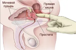 масаж на простатата у дома