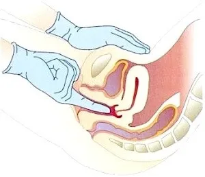 masaj al uterului in infertilitate - tipuri și tehnologii